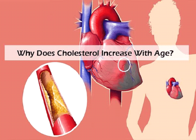 Cholesterol Increase With Age