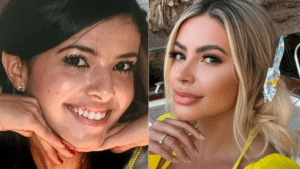 Janaina Prazeres Plastic Surgery Before and After