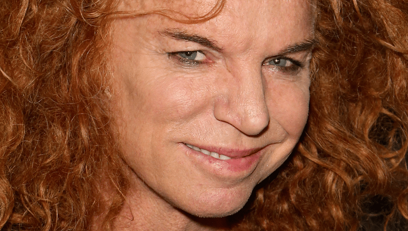 Has Carrot Top Had Plastic Surgery