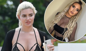 Megan Barton Hanson Weight Gain Before and After
